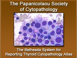 Thyroid_PapSoc